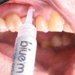 Image applying oral gel with syringe